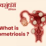 what is endometriosis