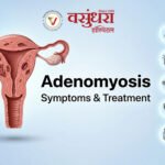What Is Adenomyosis