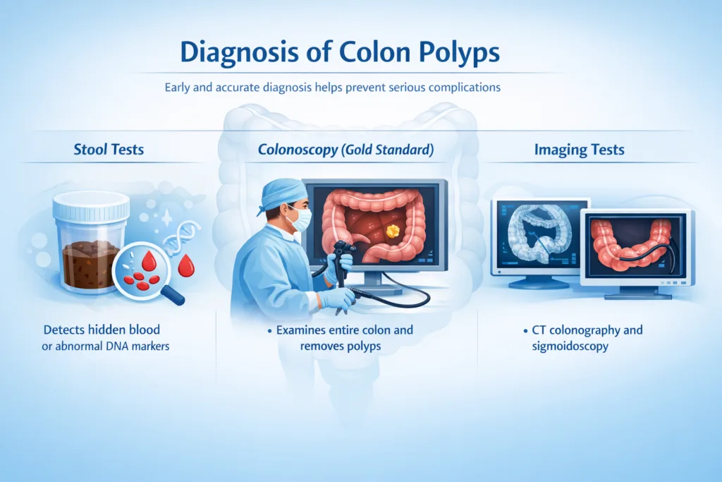colon polyps